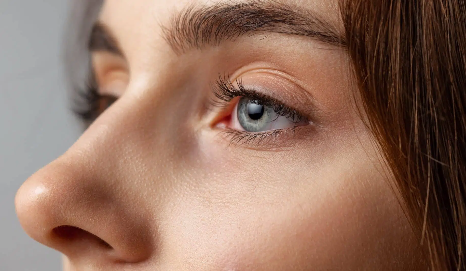 Comment corriger une bosse sur le nez sans chirurgie ? | Dr Vahedi | Paris