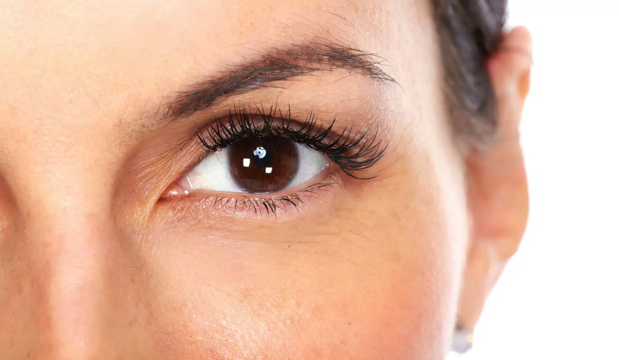 La blépharoplastie est-elle réversible ? | Dr Vahedi | Paris