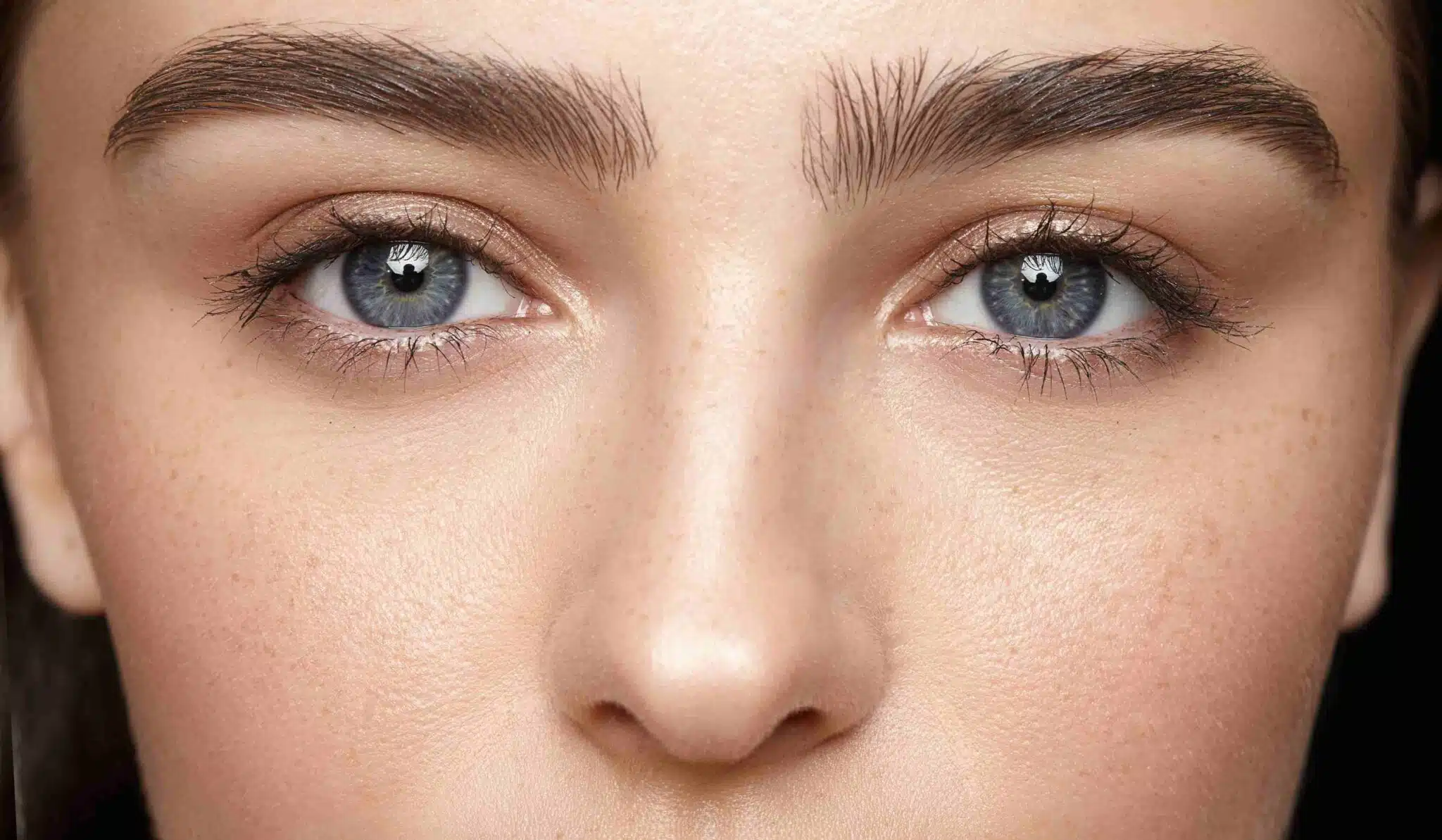 Rhinoplastie conservatrice : pour quels types de correction du nez ? | Dr Vahedi | Paris