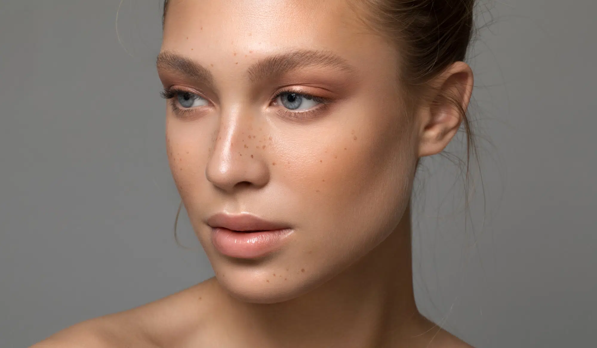 A partir de quel âge peut-on faire un micro lipofilling des cernes ? | Dr Vahedi | Paris