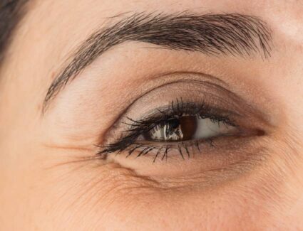 Combien de temps durent les effets d'une blépharoplastie ? | Dr Vahedi | Paris