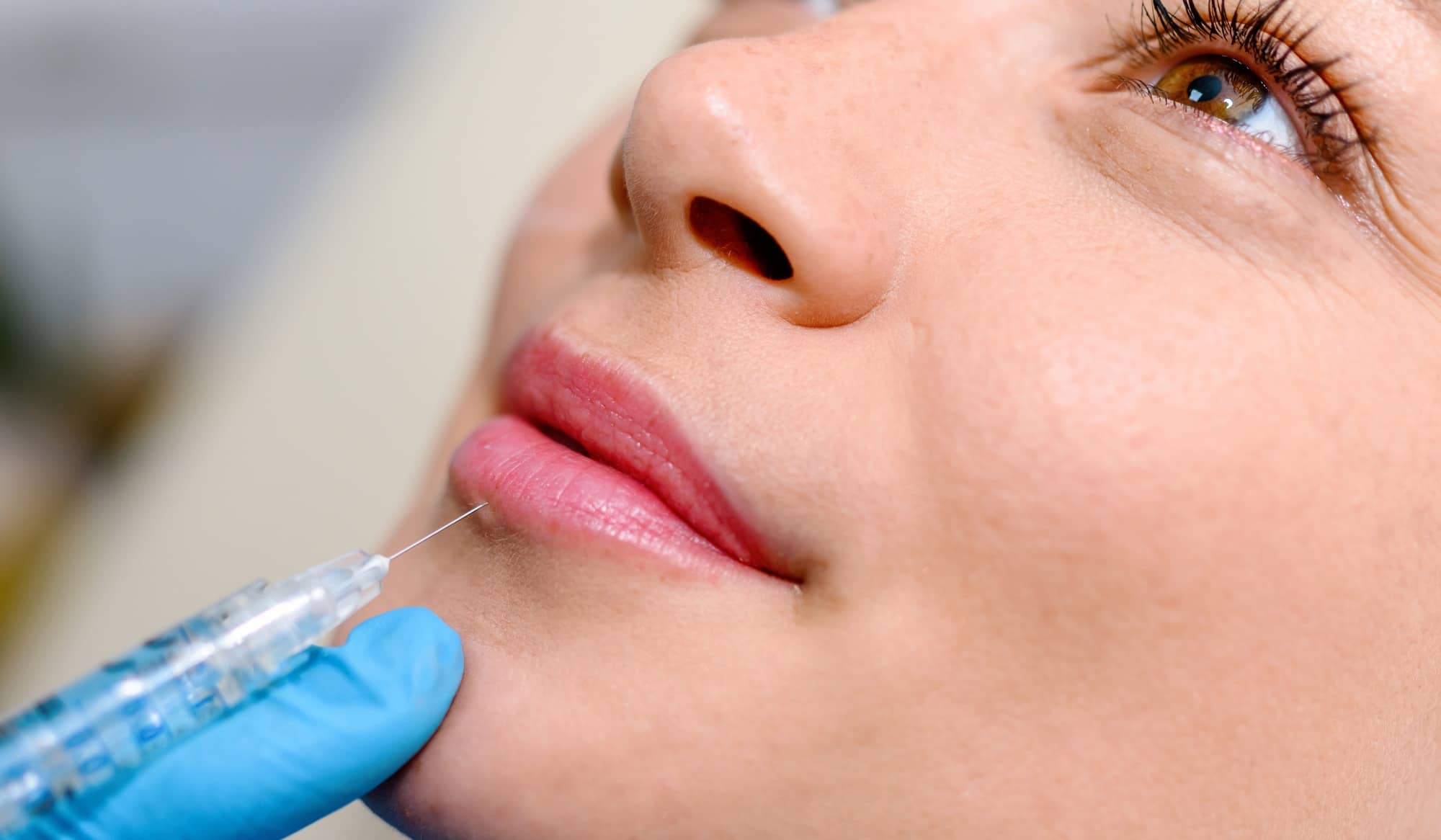 L’acide hyaluronique pour lutter contre le vieillissement des lèvres | Dr Vahedi | Paris