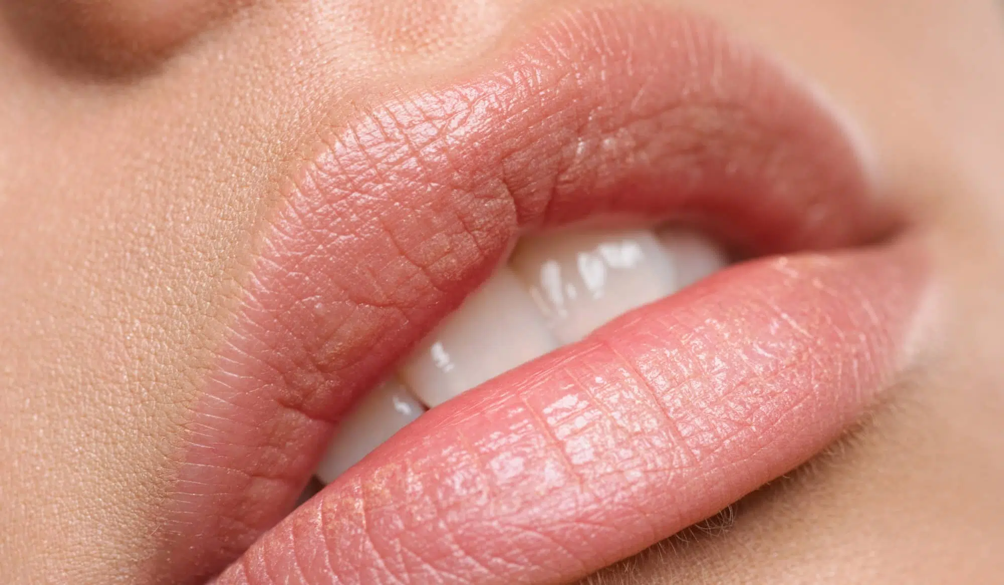 Embellir ses lèvres avec la médecine esthétique | Dr Vahedi | Paris