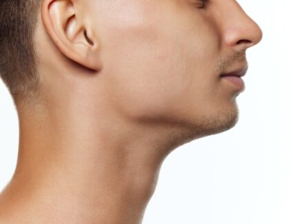 Redéfinir les contours du visage et la jawline avec et sans chirurgies avec le Dr Vahedi à Paris