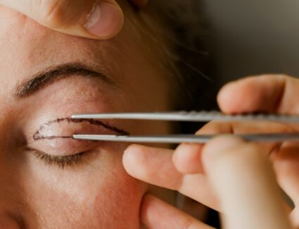 Deroulement blépharoplastie