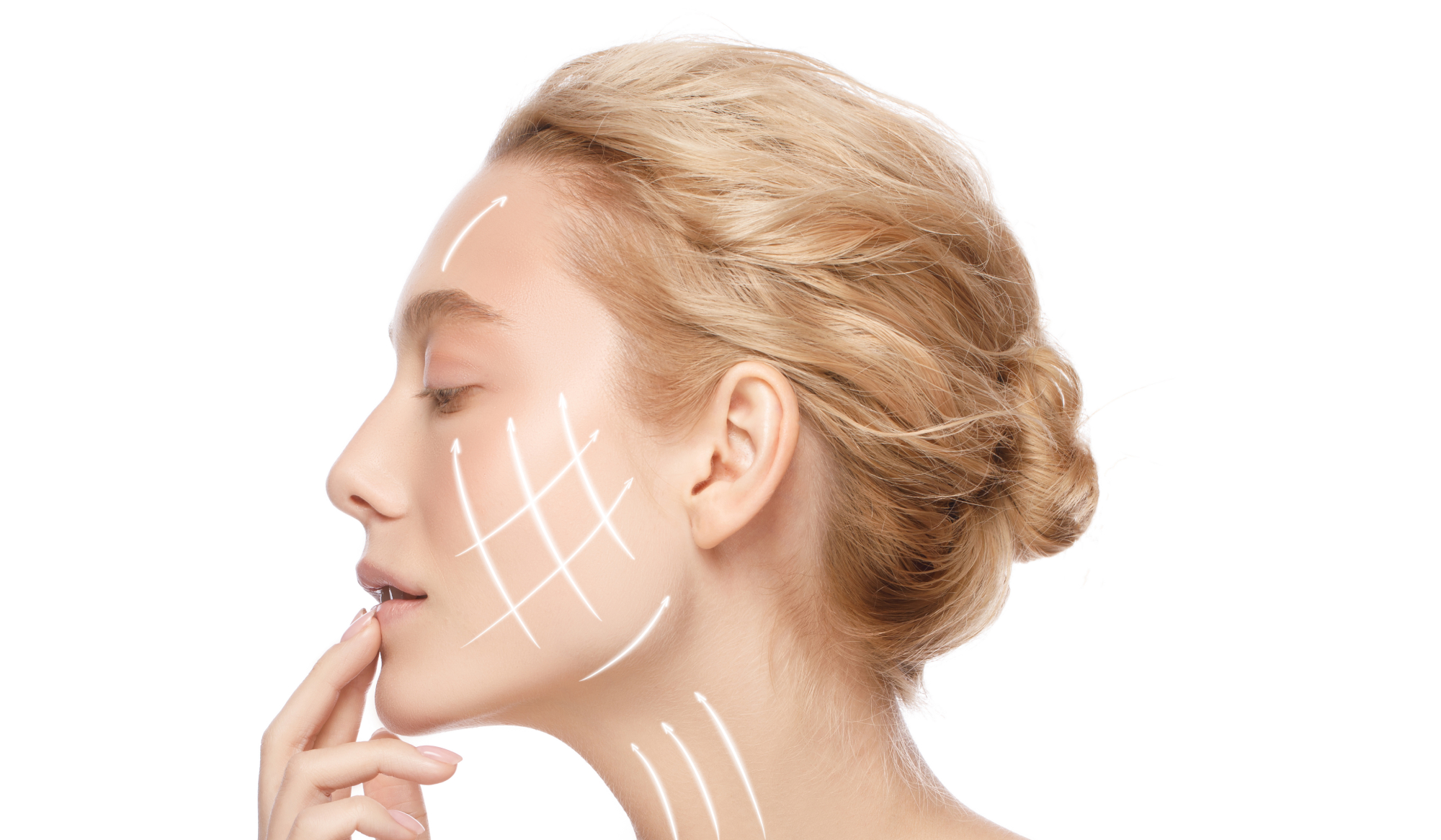 résultats avant/après d’un lifting du visage | Dr Vahedi | Paris