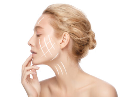 résultats avant/après d’un lifting du visage | Dr Vahedi | Paris