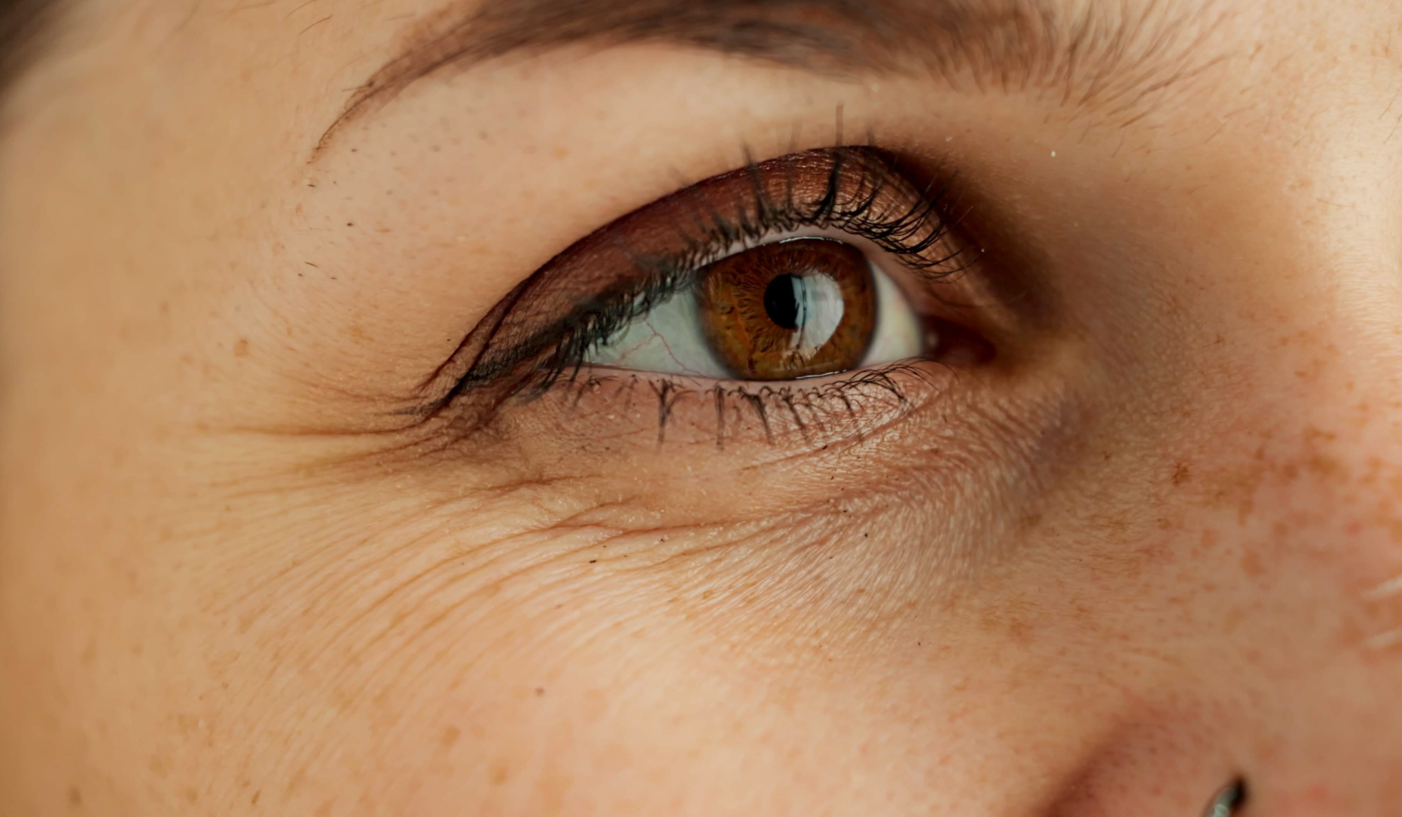 Qui peut faire une blépharoplastie ? | Dr Vahedi | Paris