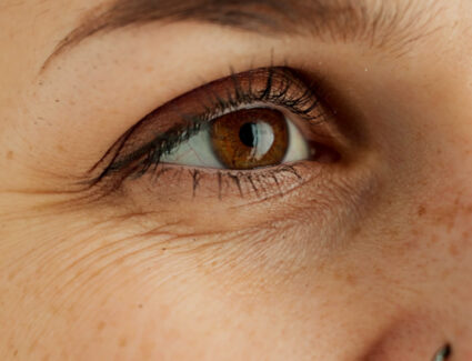 Qui peut faire une blépharoplastie ? | Dr Vahedi | Paris
